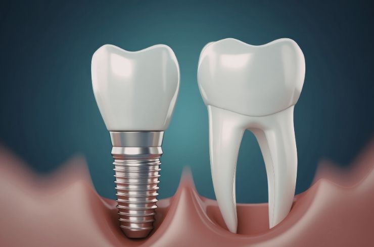 Kaamat Dental