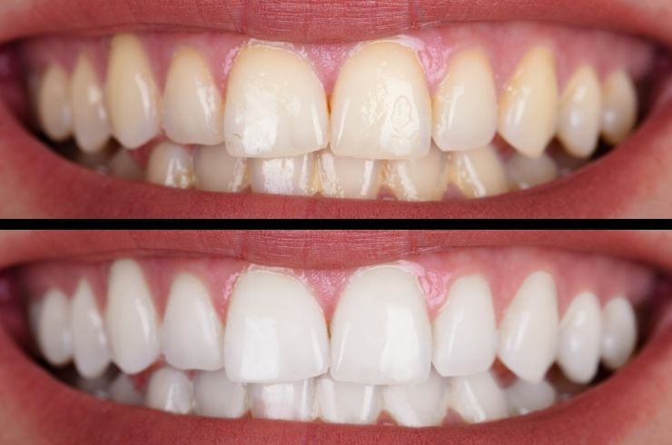 Kaamat Dental